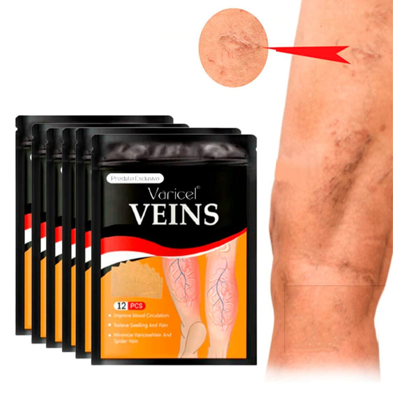VARICEL - Tratamento Para Varizes 100% Natural VARICEL - Tratamento Para Varizes 100% Natural Minha loja 