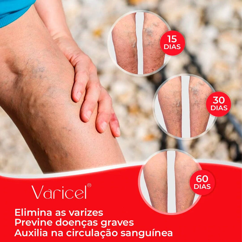 VARICEL - Tratamento Para Varizes 100% Natural VARICEL - Tratamento Para Varizes 100% Natural Minha loja 